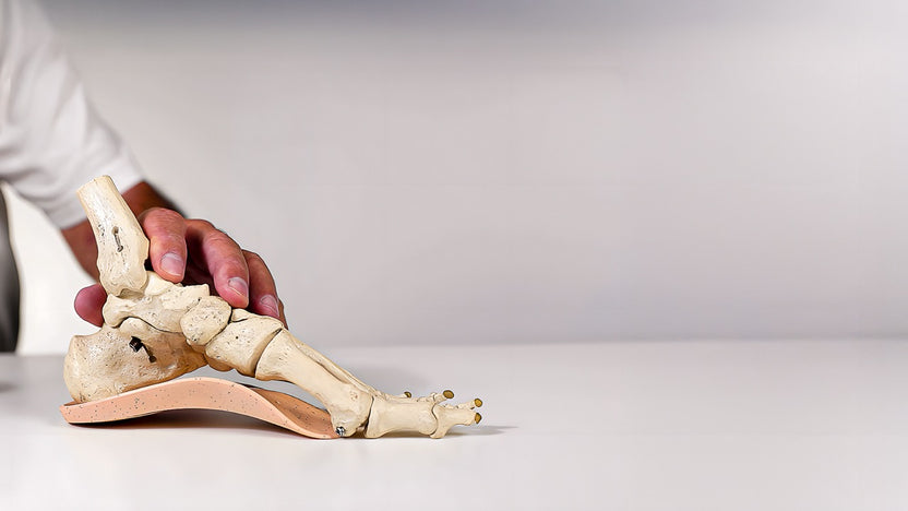 Natural Foot Orthotics: Arch Support Inserts for Plantar Fasciitis